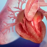 1800x1200 Medical Animation Inside Looks At Heart Failure Video.jpg